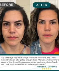 Rolimey® Botox & Stem Cell Wrinkle-Lift Tightening Cream