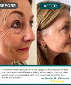 Rolimey® Botox & Stem Cell Wrinkle-Lift Tightening Cream