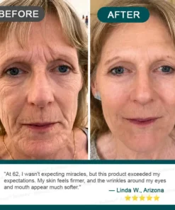 Rolimey® Botox & Stem Cell Wrinkle-Lift Tightening Cream