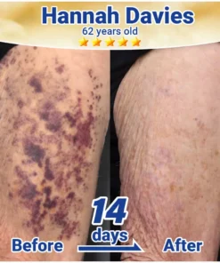 Rolimey® BruiseRepair & Skin-Strengthening Cream