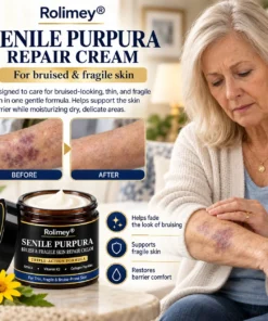 Rolimey® BruiseRepair & Skin-Strengthening Cream