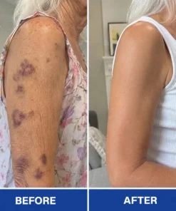 Rolimey® BruiseRepair & Skin-Strengthening Cream