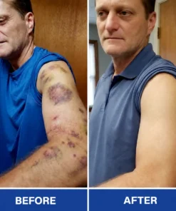 Rolimey® BruiseRepair & Skin-Strengthening Cream