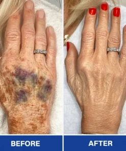 Rolimey® BruiseRepair & Skin-Strengthening Cream