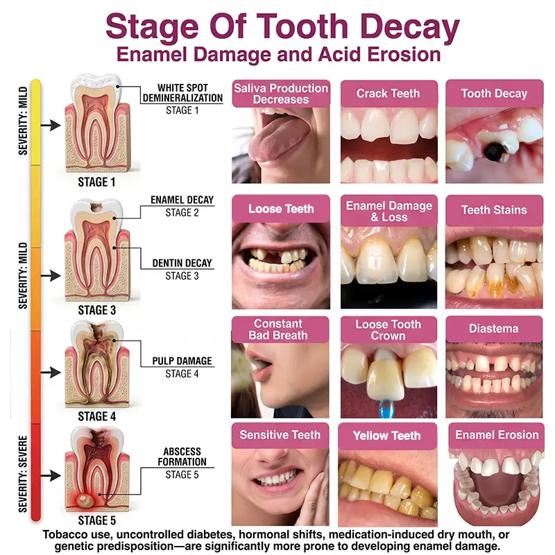 Rolimey® DenPerm Natural Enamel Restoration Gel